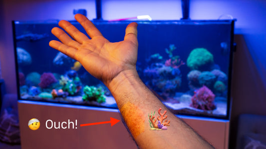 Got Stung by Coral